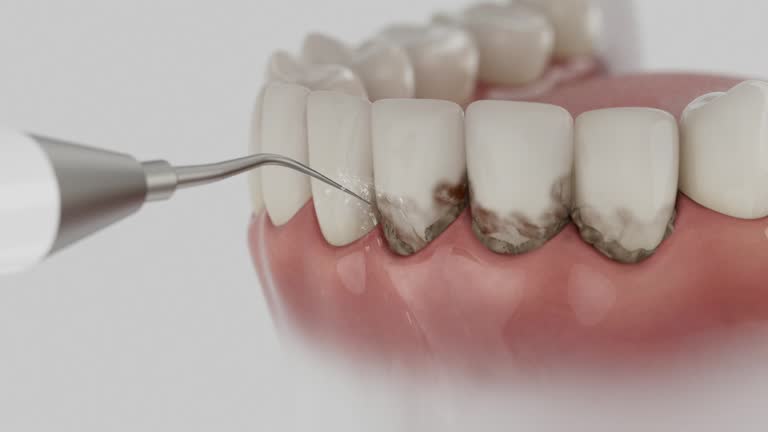 Trusted Invisalign Clear Aligners service in Campbell, FL - Dentist Open Now